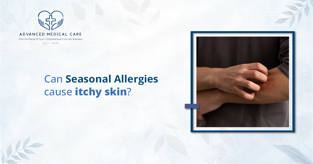 can seasonal allergies cause itchy skin