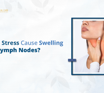 Can Stress Cause Swelling of Lymph Nodes?